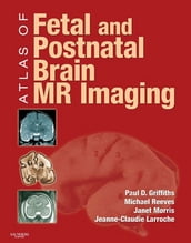 Atlas of Fetal and Infant Brain MR