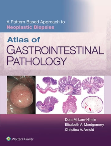 Atlas of Gastrointestinal Pathology: A Pattern Based Approach to Neoplastic Biopsies - Christina Arnold - Dora Lam-Himlin - Elizabeth A. Montgomery