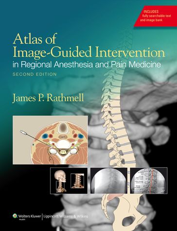 Atlas of Image-Guided Intervention in Regional Anesthesia and Pain Medicine - James P. Rathmell