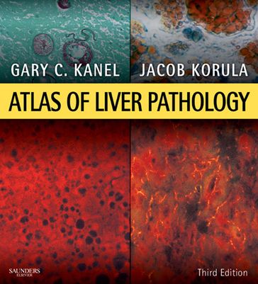 Atlas of Liver Pathology E-Book - MD Gary C. Kanel - MD  FRCPC  FACP Jacob Korula