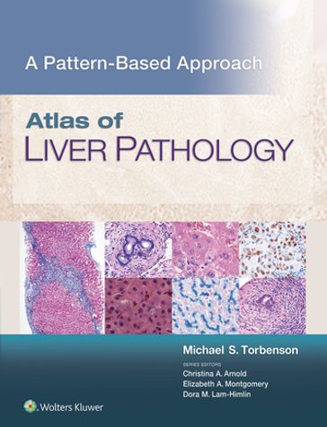 Atlas of Liver Pathology: A Pattern-Based Approach - Michael Torbenson