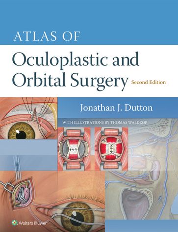 Atlas of Oculoplastic and Orbital Surgery - Jonathan Dutton