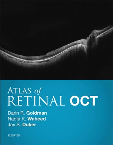 Atlas of Retinal OCT E-Book - MD Jay S. Duker - MD Darin Goldman - MD MPH Nadia K. Waheed