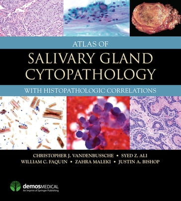 Atlas of Salivary Gland Cytopathology - MD  PhD Christopher J. VandenBussche - MD Justin Bishop - MD  FRCPath  FIAC Syed Z. Ali - MD  PhD William C. Faquin - MD Zahra Maleki