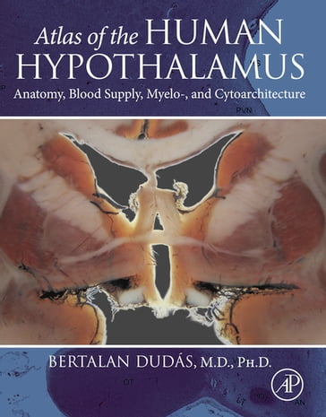 Atlas of the Human Hypothalamus - Bertalan Dudas - Ph.D. Habil.