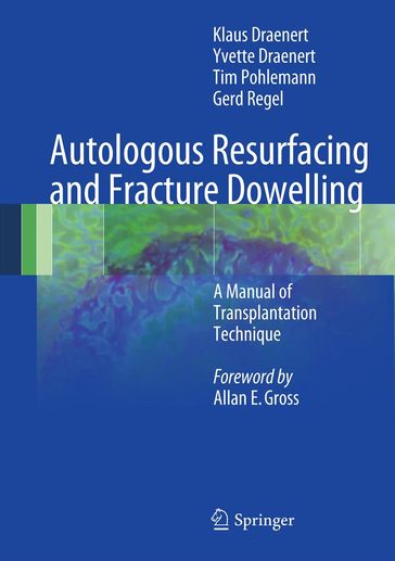 Autologous Resurfacing and Fracture Dowelling - Klaus Draenert - Yvette Draenert - Tim Pohlemann - Gerd Regel