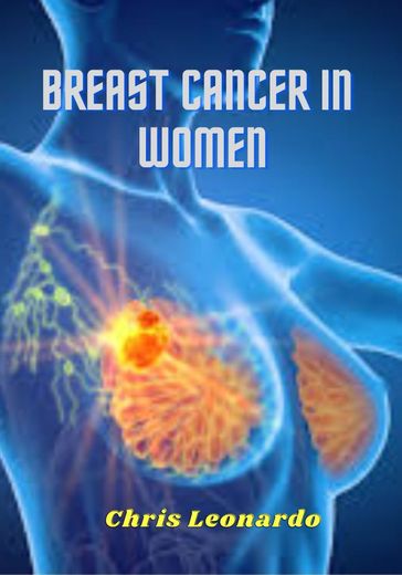 BREAST CANCER IN WOMEN - mgbakogu Callistus