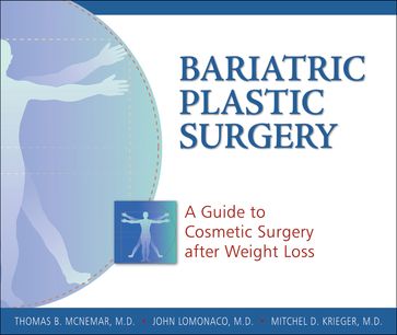 Bariatric Plastic Surgery - John LoMonaco - Mitchel D. Krieger - Thomas B. McNemar