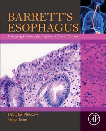 Barrett's Esophagus - Tolga Erim - MD Douglas Pleskow