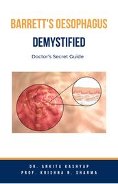 Barretts Oesophagus Demystified: Doctor s Secret Guide