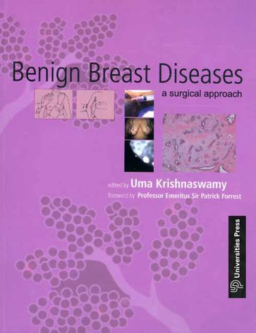 Benign Breast Diseases - Uma Krishnaswamy