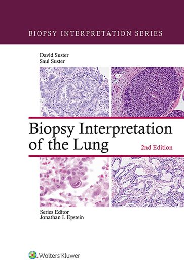 Biopsy Interpretation of the Lung - David Suster - Saul Suster