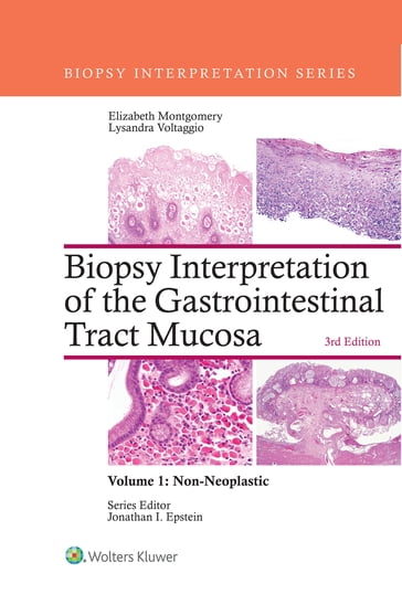 Biopsy Interpretation of the Gastrointestinal Tract Mucosa: Volume 1: Non-Neoplastic - Elizabeth A. Montgomery - Lysandra Voltaggio