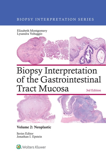Biopsy Interpretation of the Gastrointestinal Tract Mucosa: Volume 2: Neoplastic - Elizabeth A. Montgomery - Lysandra Voltaggio