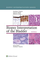 Biopsy Interpretation of the Bladder