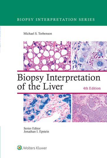 Biopsy Interpretation of the Liver - Michael Torbenson