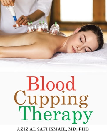 Blood Cupping Therapy - Aziz Al Safi Ismail