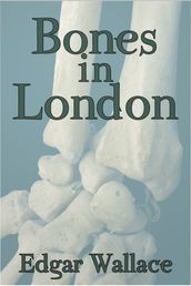 Bones in London