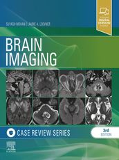 Brain Imaging: Case Review Series