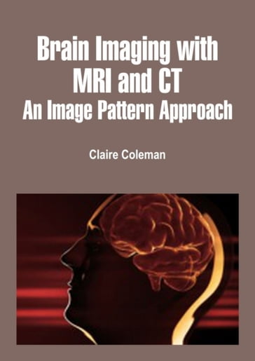 Brain Imaging with MRI and CT - Claire Coleman