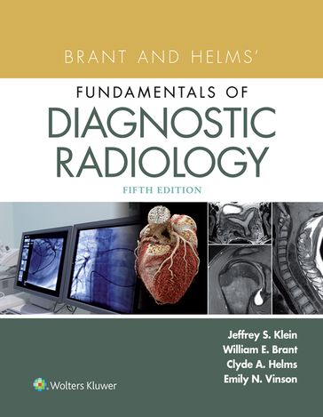 Brant and Helms' Fundamentals of Diagnostic Radiology - Clyde A. Helms - Emily N. Vinson - Jeffrey Klein - Jennifer Pohl - William E. Brant