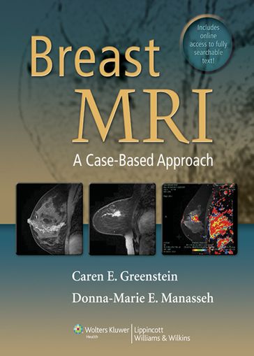Breast MRI - Caren Greenstein