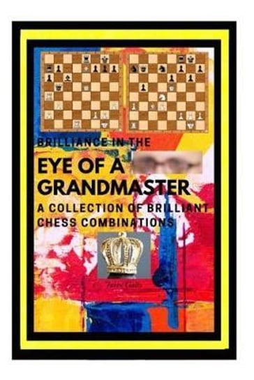 Brilliance in the Eye of a Grandmaster - Jurex Gallo