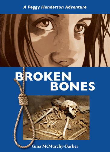 Broken Bones - Gina McMurchy-Barber
