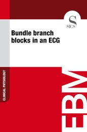 Bundle Branch Blocks in an ECG