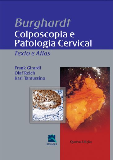 Burghardt  colposcopia e patologia cervical - Frank Girardi - Olaf Reich - Karl Tamussino - Hellmuth Pickel
