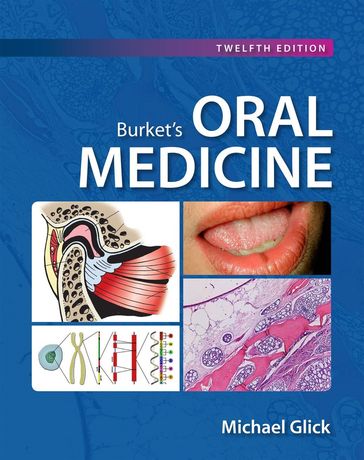 Burket's Oral Medicine, 12e - Michael Glick
