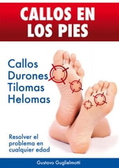 CALLOS EN LOS PIES - Solución definitiva para Callos, Tilomas y Helomas.