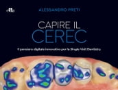 Capire il CEREC