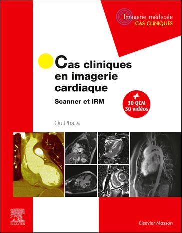 Cas cliniques en imagerie cardiaque - Phalla Ou - Jean-Louis Dietemann