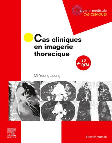 Cas cliniques en imagerie thoracique - Mi-Young Jeung