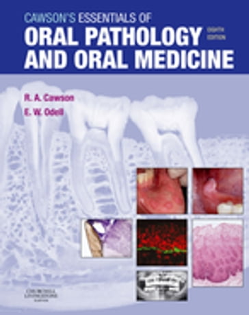 Cawson's Essentials of Oral Pathology and Oral Medicine E-Book - MD  FDSRCS  FDSRCPS(Glas)  FRCPath  FAAOMP Roderick A. Cawson - FDSRCS  MSc  PhD  FRCPath Edward W Odell
