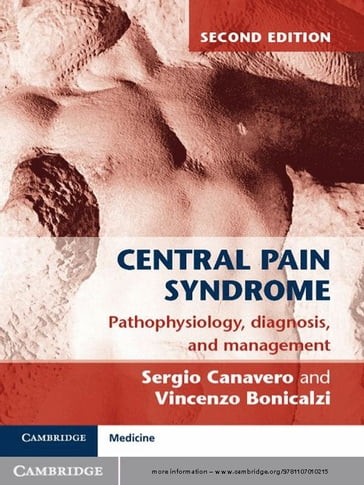 Central Pain Syndrome - Sergio Canavero - Vincenzo Bonicalzi