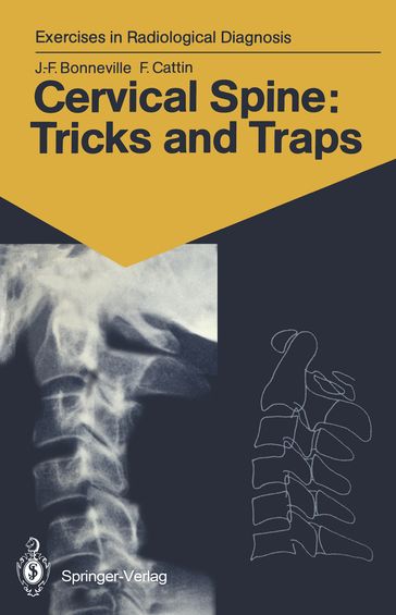 Cervical Spine: Tricks and Traps - Jean-Francois Bonneville - Francoise Cattin