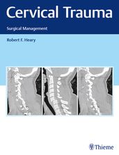 Cervical Trauma