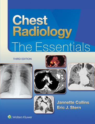 Chest Radiology: The Essentials - Eric J. Stern - Janette Collins