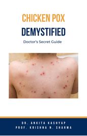 Chickenpox Demystified: Doctor s Secret Guide