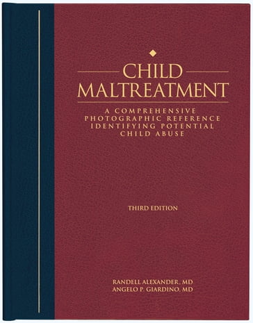 Child Maltreatment 3e, Volume 2 - MD  PhD  MPH  FAAP Angelo Giardino - MD  PhD  FAAP Randell Alexander