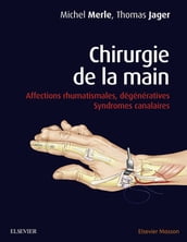 Chirurgie de la main