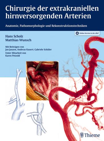 Chirurgie der extrakraniellen hirnversorgenden Arterien - Hans Scholz - Matthias Wunsch - Jan Janzen - Andreas Kauert - Karen Petzold