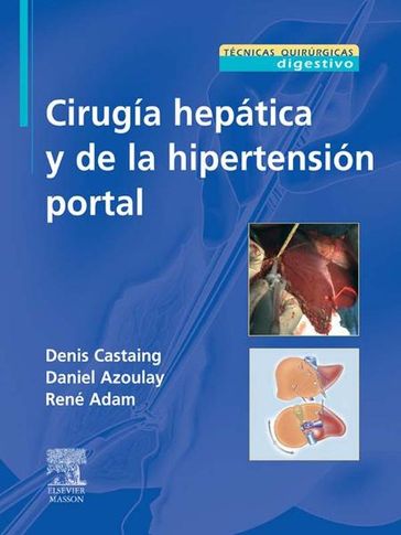 Cirugía hepática y de la hipertensión portal - Denis Castaing - Daniel Azoulay - René Adam