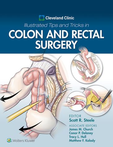 Cleveland Clinic Illustrated Tips and Tricks in Colon and Rectal Surgery - Scott Steele