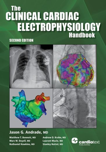 Clinical Cardiac Electrophysiology Handbook, Second Edition - MD Jason Andrade