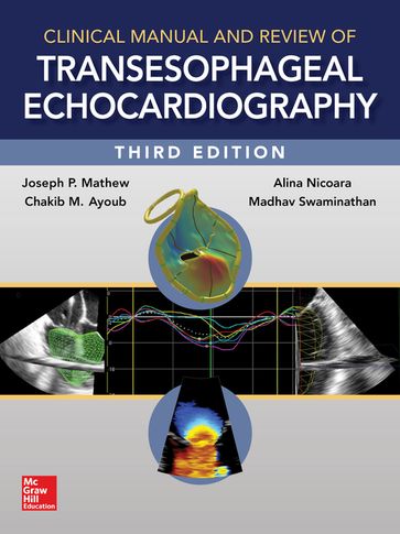 Clinical Manual and Review of Transesophageal Echocardiography, 3/e - Joseph Mathew - Madhav Swaminathan - Chakib Ayoub
