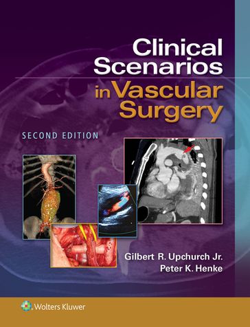 Clinical Scenarios in Vascular Surgery - Gilbert R. Upchurch - Peter K. Henke