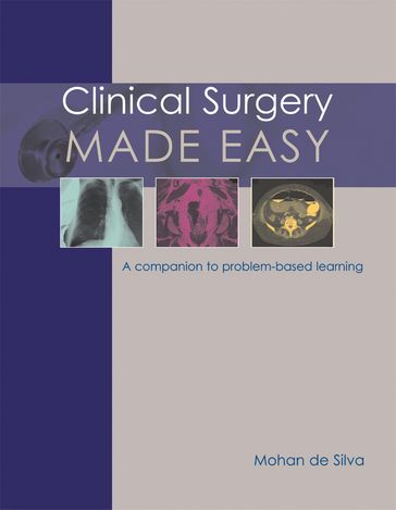 Clinical Surgery Made Easy - Mohan de Silva